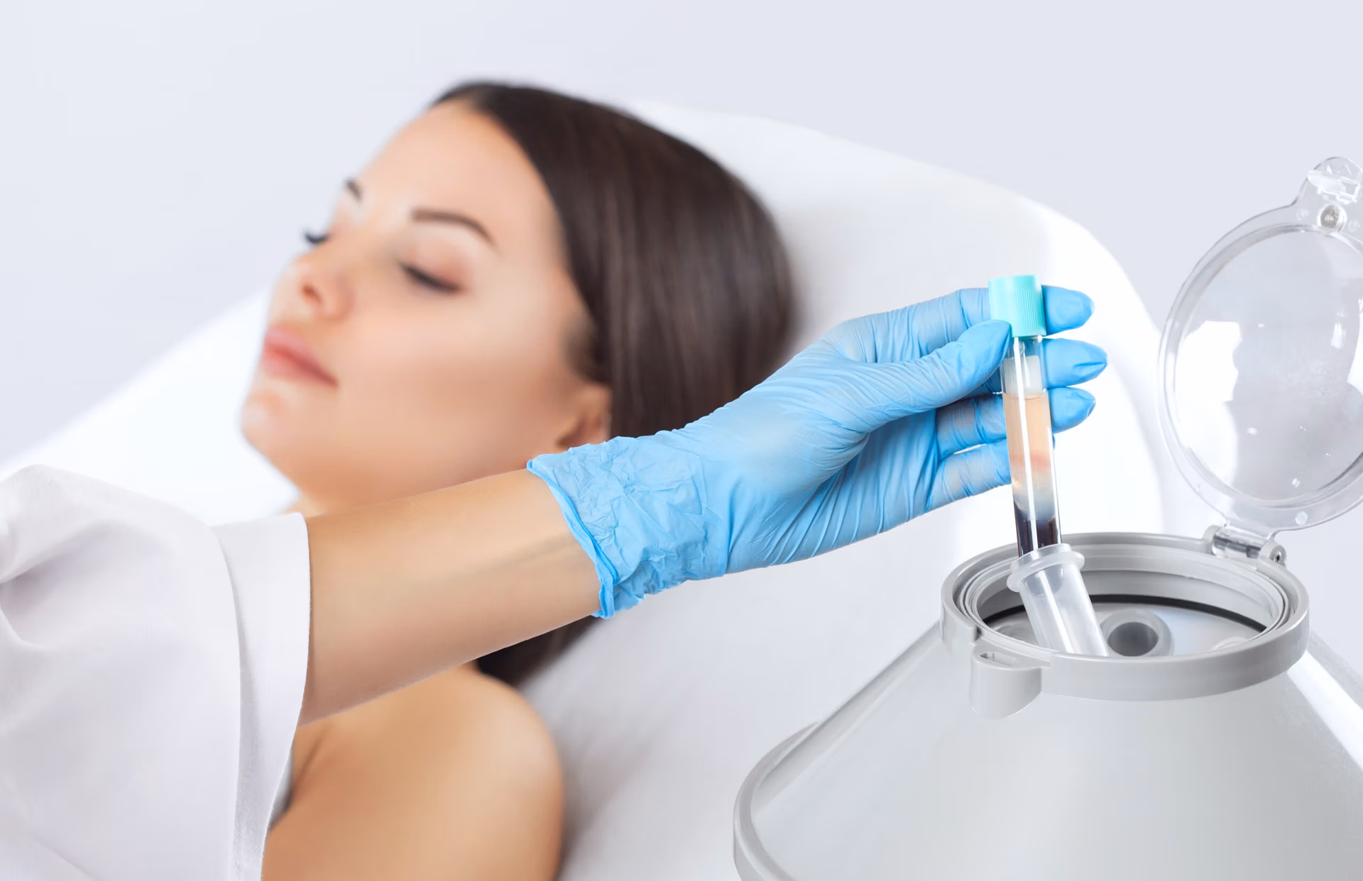 PRP Treatment in New Jersey | Anara Medspa