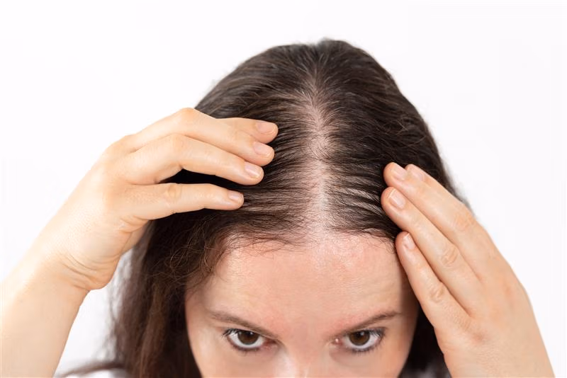 hair_restore1 KeraLase Hair Restoration Before