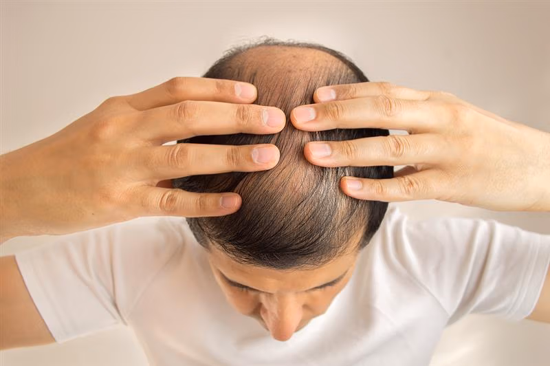 hair_restore_small-2 KeraLase Hair Restoration